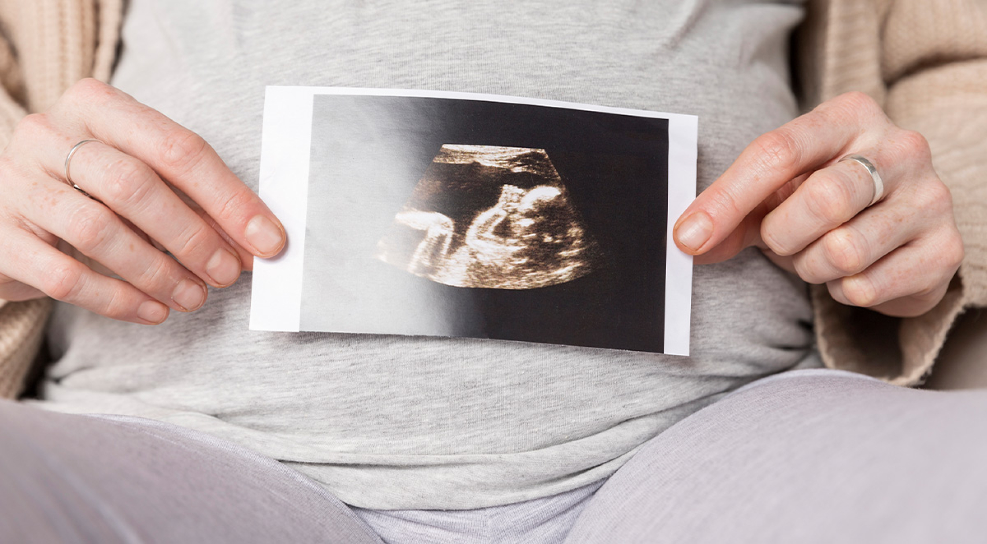 How Doulas Can Help During High-Risk Pregnancies