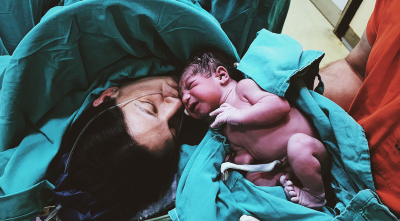 How Doulas Help During Cesareans